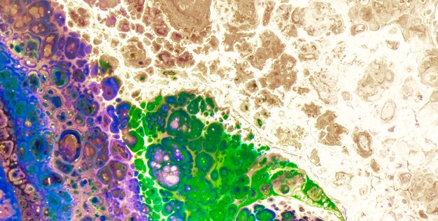 A detailed microscopic image of cancer cells being targeted and destroyed by immune cells, with contrasting colors to highlight the interaction and effectiveness of immunotherapy.