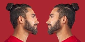 Chin Augmentation: Transform Your Face with a 10mm Implant - Cover Image