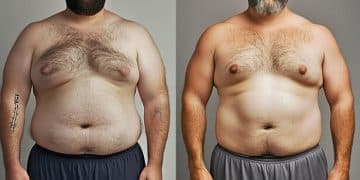 Tummy Tuck: Your Guide to a Flatter Stomach in 9 Months - Cover Image