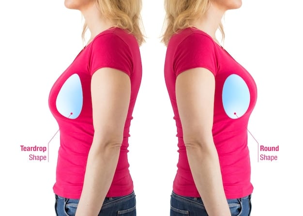 A close-up comparison of round and teardrop breast implants, showing the difference in their shape and how they might look when implanted.