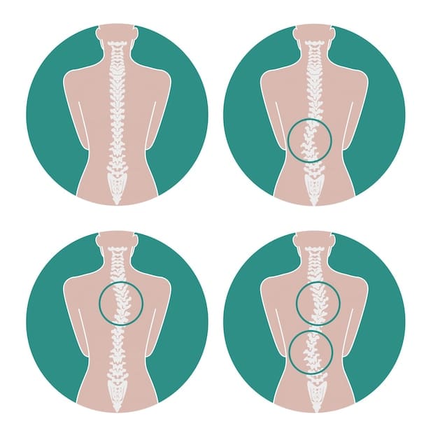A diagram showing the correct spinal alignment in contrast to the spinal misalignment caused by the weight of large breasts, highlighting the strain on the back muscles.