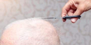 FUT vs. FUE: Choosing the Best Hair Transplant in 2025 - Cover Image