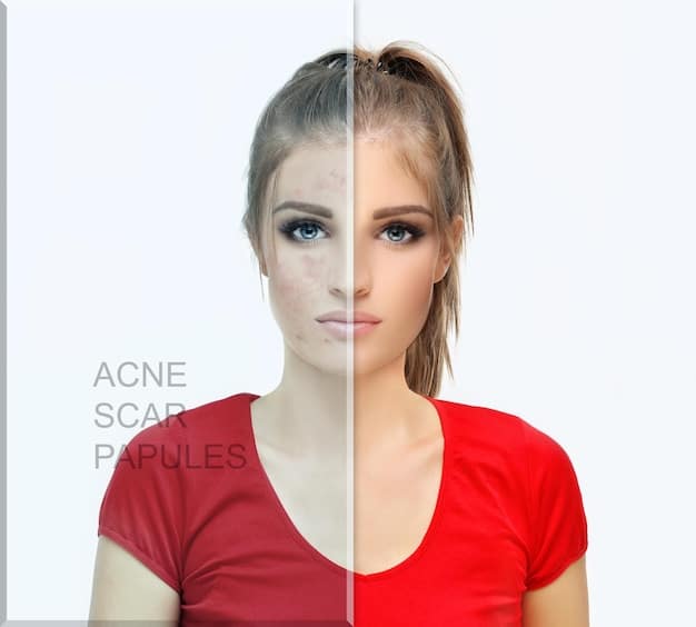 Before and after photo of a patient who underwent laser skin resurfacing. The 'before' photo shows prominent wrinkles and sun damage, while the 'after' photo displays significantly smoother skin with reduced wrinkles and improved skin tone.