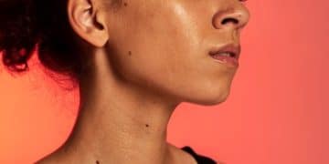 Treating Hyperpigmentation: Fading Dark Spots in 6 Months - Cover Image