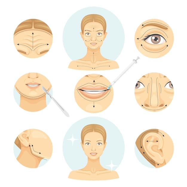 A surgical diagram showing the incision lines and areas of skin and fat removal for both upper and lower blepharoplasty. The diagram is clear and educational.