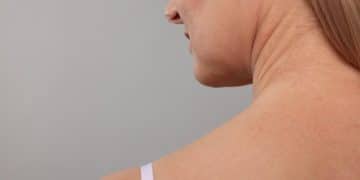 Neck Lift Surgery 2025: Smooth, Defined Neck Profile Guide - Cover Image