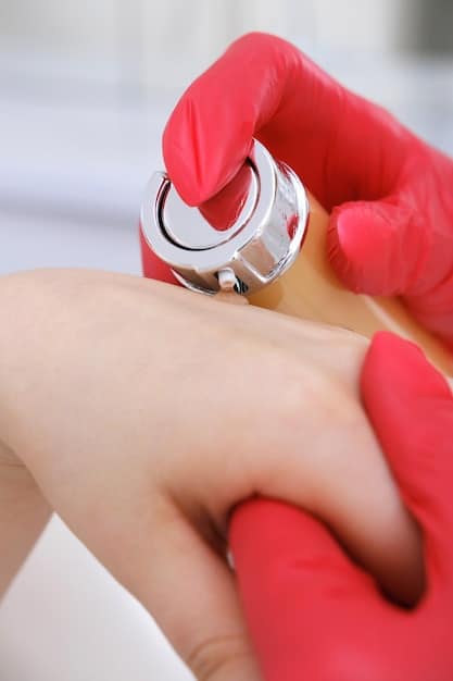 A close-up side view of a dermatologist's hand using a dermabrasion rotary tool on a patient's cheek, showing the precise action on the skin.