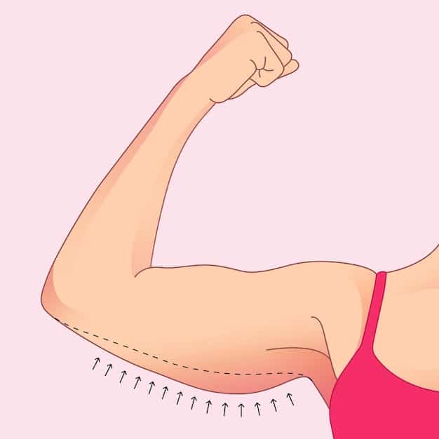A detailed illustration contrasting saggy, loose upper arm skin with a smooth, toned arm contour often achieved through brachioplasty, highlighting the before and after transformations.