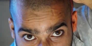 FUT vs. FUE Hair Transplant: Best Hairline in 2025? - Cover Image
