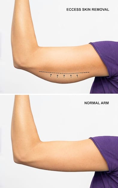 Scar Revision Surgery: Minimize Scars by Up to 50%