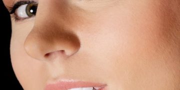 Lip Lift Techniques 2025: Shorten Your Nose-Lip Distance by 7mm - Cover Image
